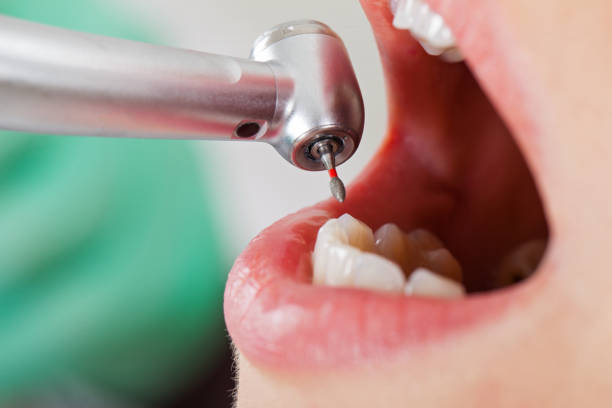 Best Dentist Open Late Near Me  in North Yelm, WA